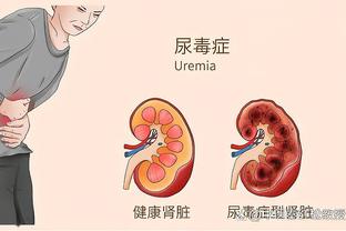 纳斯：我知道OG和巴雷特有多优秀 希望这让两队都变糟糕了